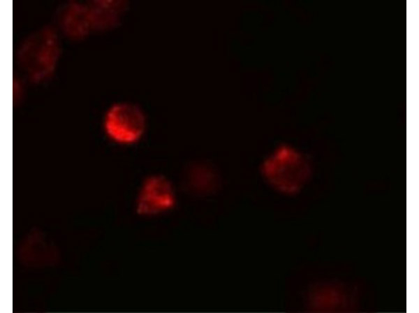 LIF Antibody in Immunocytochemistry (ICC/IF)