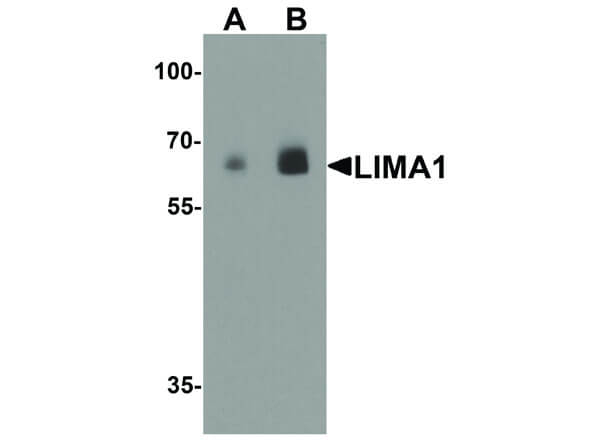 LIMA1 Antibody in Western Blot (WB)