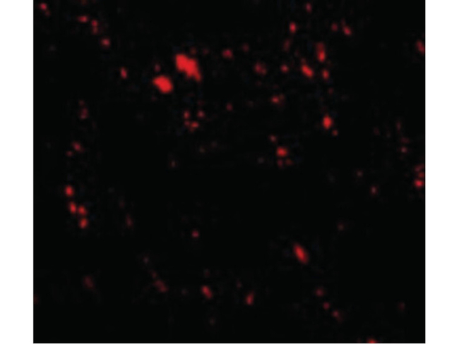 LIMP2 Antibody in Immunocytochemistry (ICC/IF)