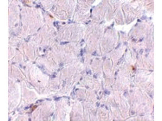 LIMP2 Antibody in Immunohistochemistry (Paraffin) (IHC (P))