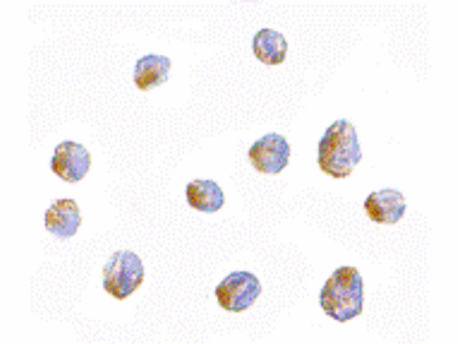 LIS1 Antibody in Immunocytochemistry (ICC/IF)