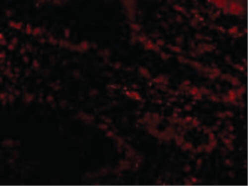 Livin Antibody in Immunocytochemistry (ICC/IF)