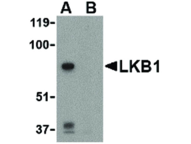 LKB1 Antibody in Western Blot (WB)