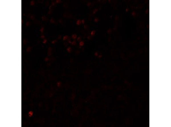 LMBRD1 Antibody in Immunocytochemistry (ICC/IF)