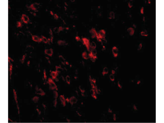 LRFN1 Antibody in Immunocytochemistry (ICC/IF)