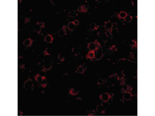 LRFN2 Antibody in Immunocytochemistry (ICC/IF)