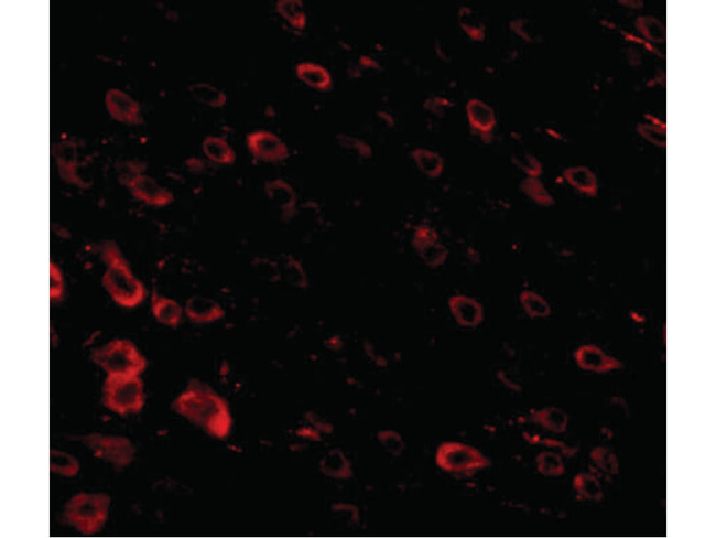 LRFN3 Antibody in Immunocytochemistry (ICC/IF)