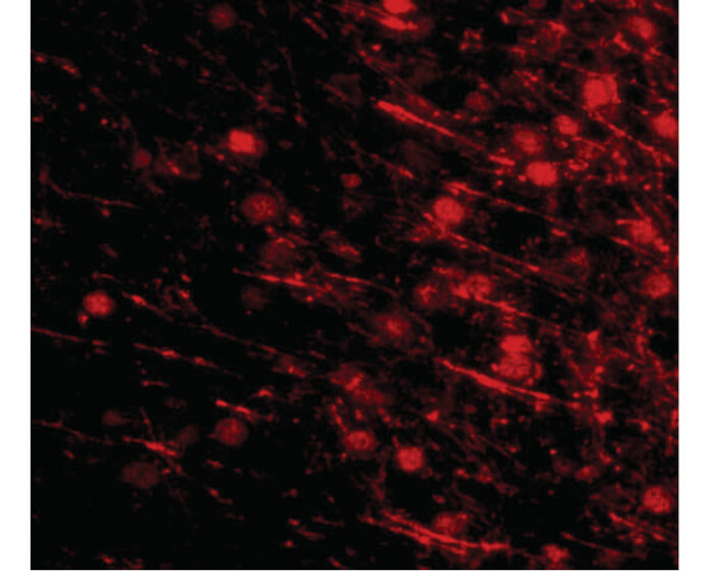 LRFN4 Antibody in Immunocytochemistry (ICC/IF)
