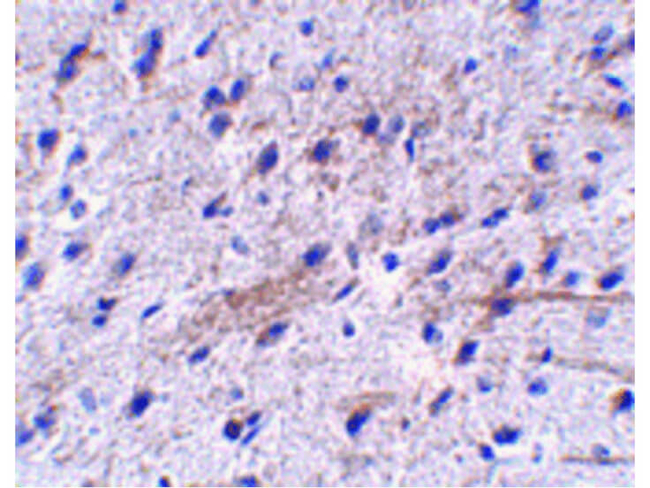 LRFN5 Antibody in Immunohistochemistry (Paraffin) (IHC (P))