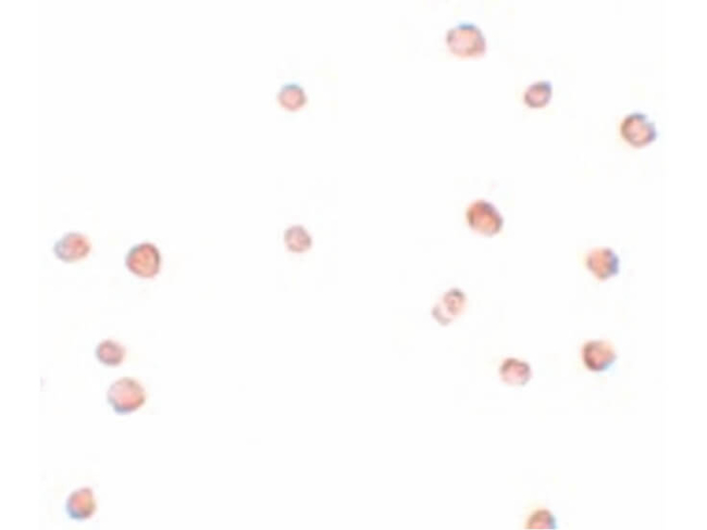 LRRC19 Antibody in Immunocytochemistry (ICC/IF)