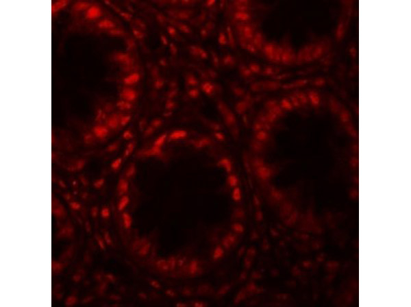 LRRFIP1 Antibody in Immunocytochemistry (ICC/IF)