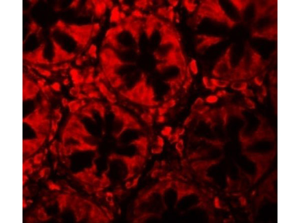 LRRFIP2 Antibody in Immunocytochemistry (ICC/IF)