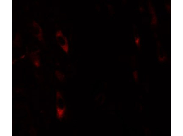 LRRTM1 Antibody in Immunocytochemistry (ICC/IF)