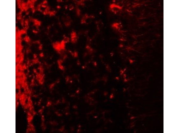 LRRTM2 Antibody in Immunocytochemistry (ICC/IF)