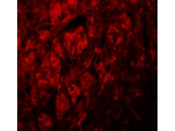 LRRTM3 Antibody in Immunocytochemistry (ICC/IF)