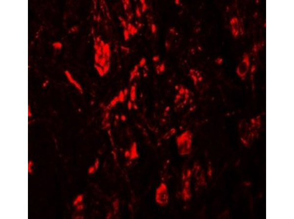 LRRTM4 Antibody in Immunocytochemistry (ICC/IF)