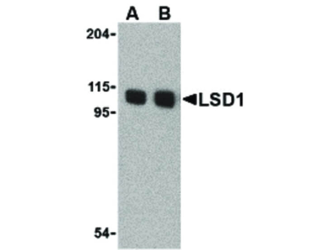 LSD1 Antibody in Western Blot (WB)