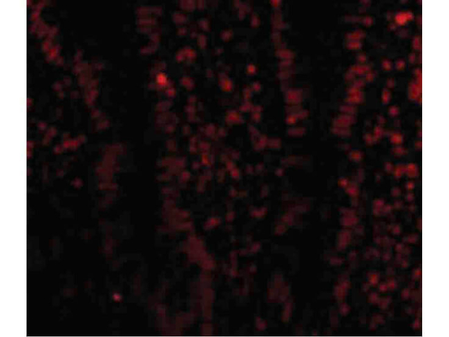 LSD1 Antibody in Immunocytochemistry (ICC/IF)