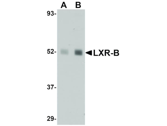 LXR-B Antibody in Western Blot (WB)