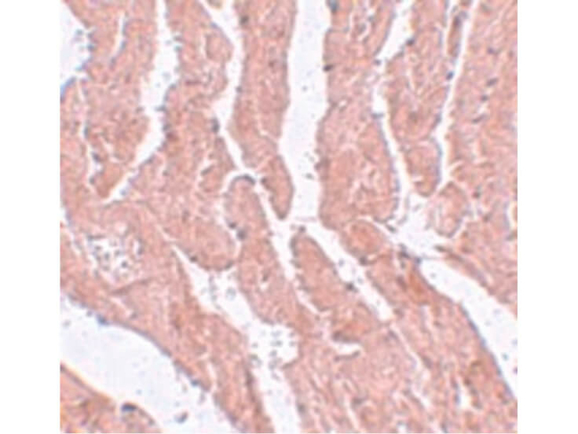 LZTR1 Antibody in Immunohistochemistry (Paraffin) (IHC (P))
