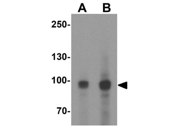 MALT1 Antibody in Western Blot (WB)
