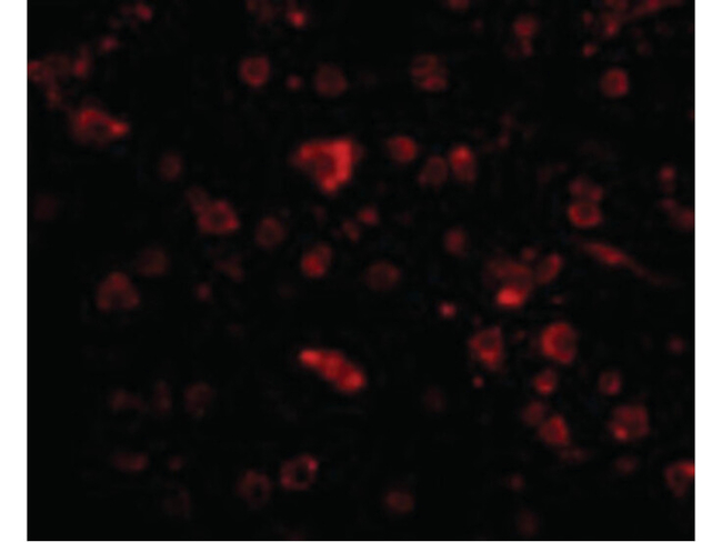 MANF Antibody in Immunocytochemistry (ICC/IF)