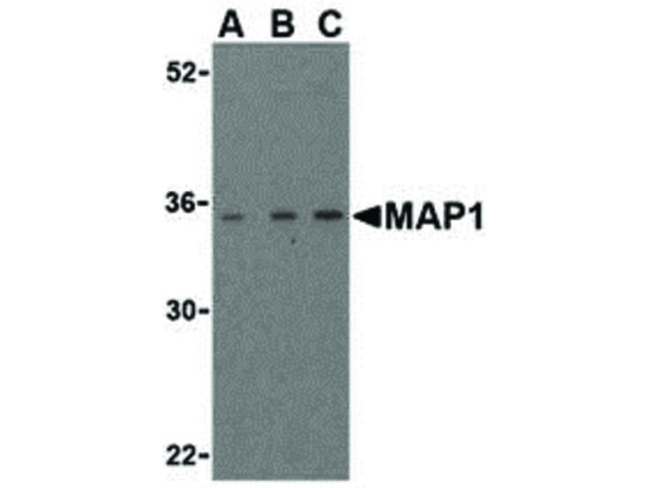 MAP1 Antibody in Western Blot (WB)