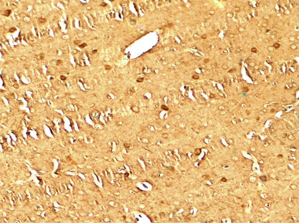 MAP1LC3 Antibody in Immunohistochemistry (Paraffin) (IHC (P))