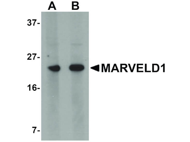 MARVELD1 Antibody in Western Blot (WB)