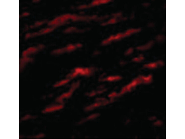 MATN1 Antibody in Immunocytochemistry (ICC/IF)