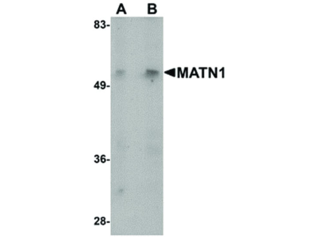 MATN1 Antibody in Western Blot (WB)
