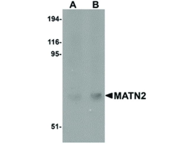 MATN2 Antibody in Western Blot (WB)