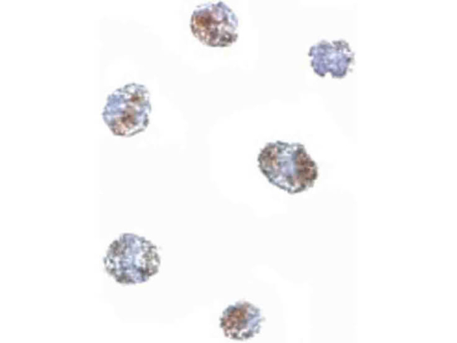 MATN3 Antibody in Immunocytochemistry (ICC/IF)