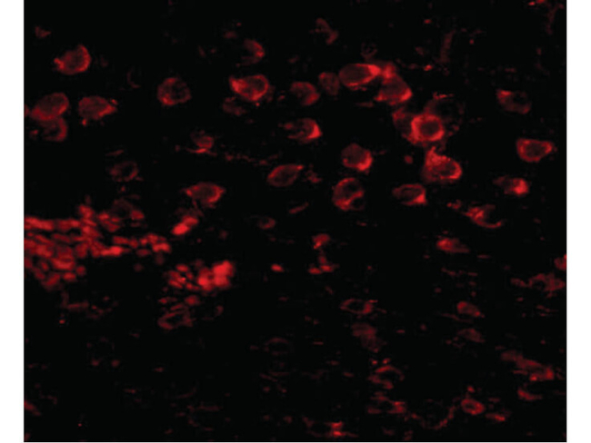 MATN4 Antibody in Immunocytochemistry (ICC/IF)