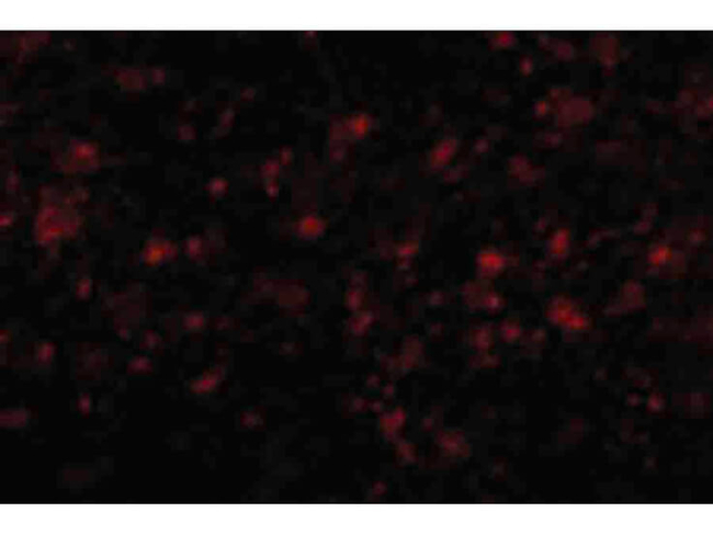 MC4R Antibody in Immunocytochemistry (ICC/IF)