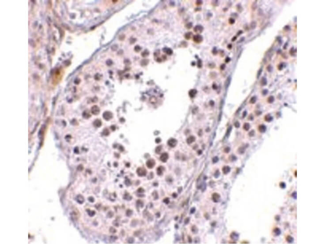 MED4 Antibody in Immunohistochemistry (Paraffin) (IHC (P))