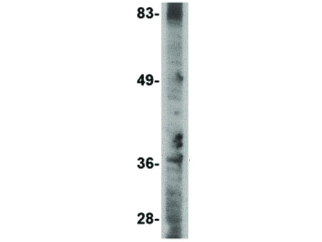 MettL7A Antibody in Western Blot (WB)
