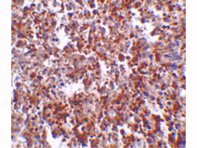 MettL7B Antibody in Immunohistochemistry (Paraffin) (IHC (P))