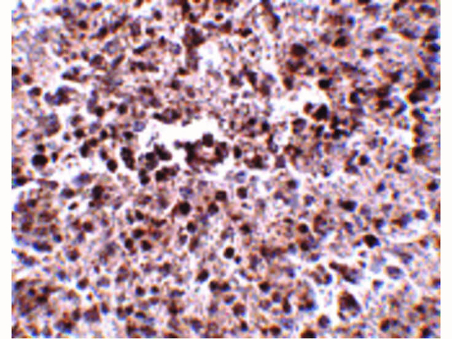 MettL7B Antibody in Immunohistochemistry (Paraffin) (IHC (P))