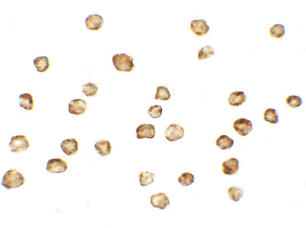MFN1 Antibody in Immunocytochemistry (ICC/IF)
