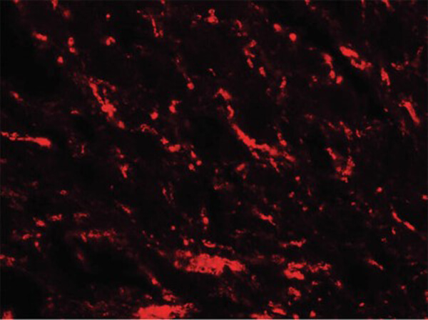 MFN2 Antibody in Immunocytochemistry (ICC/IF)