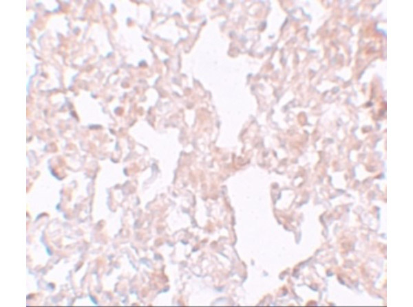 MFSD1 Antibody in Immunohistochemistry (Paraffin) (IHC (P))