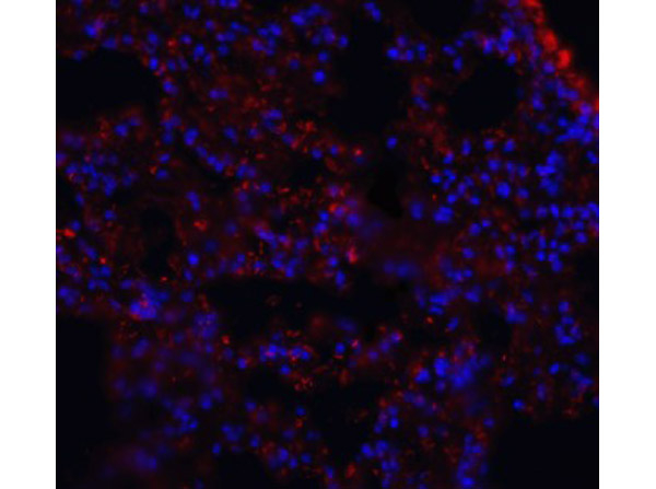 MFSD2A Antibody in Immunocytochemistry (ICC/IF)