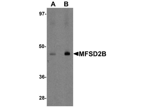 MFSD2B Antibody in Western Blot (WB)