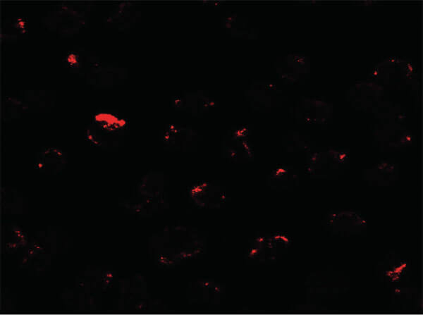 MIB1 Antibody in Immunocytochemistry (ICC/IF)