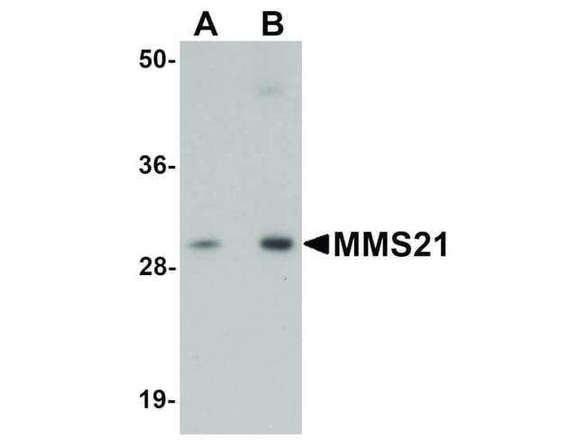 MMS21 Antibody in Western Blot (WB)
