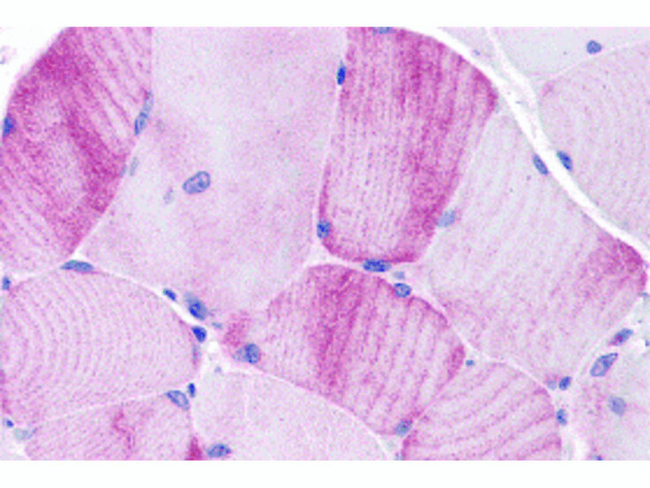 MYBPC1 Antibody in Immunohistochemistry (Paraffin) (IHC (P))
