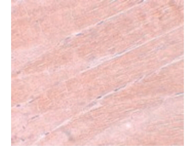 MYBPC2 Antibody in Immunohistochemistry (Paraffin) (IHC (P))