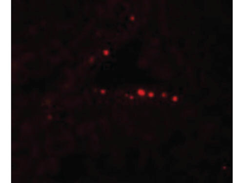 MYD88 Antibody in Immunocytochemistry (ICC/IF)