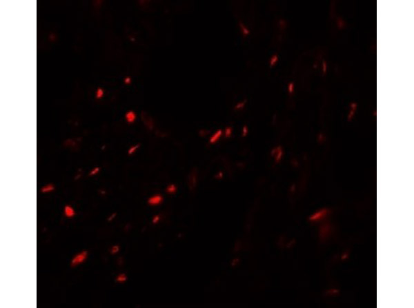 MYOZAP Antibody in Immunocytochemistry (ICC/IF)